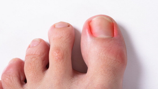 Ребристые ногти: внимание на здоровье